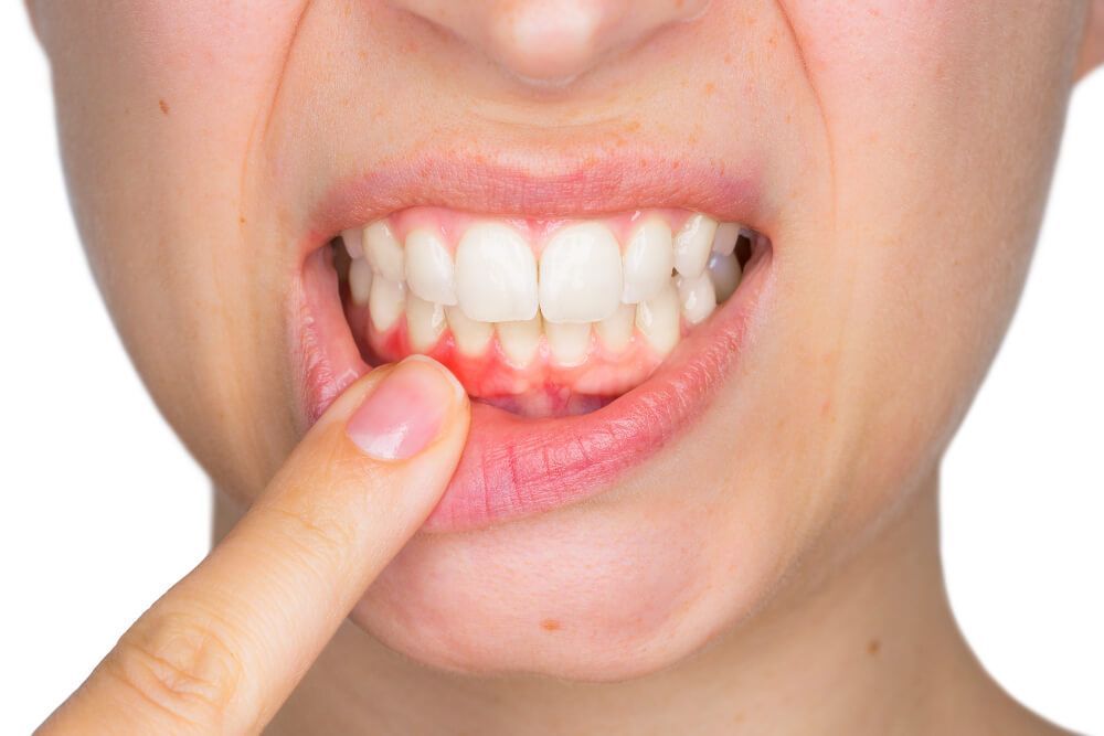 Periodontal care in Naperville