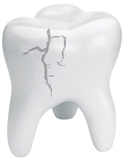 Emergency dentist treating a cracked tooth in Naperville