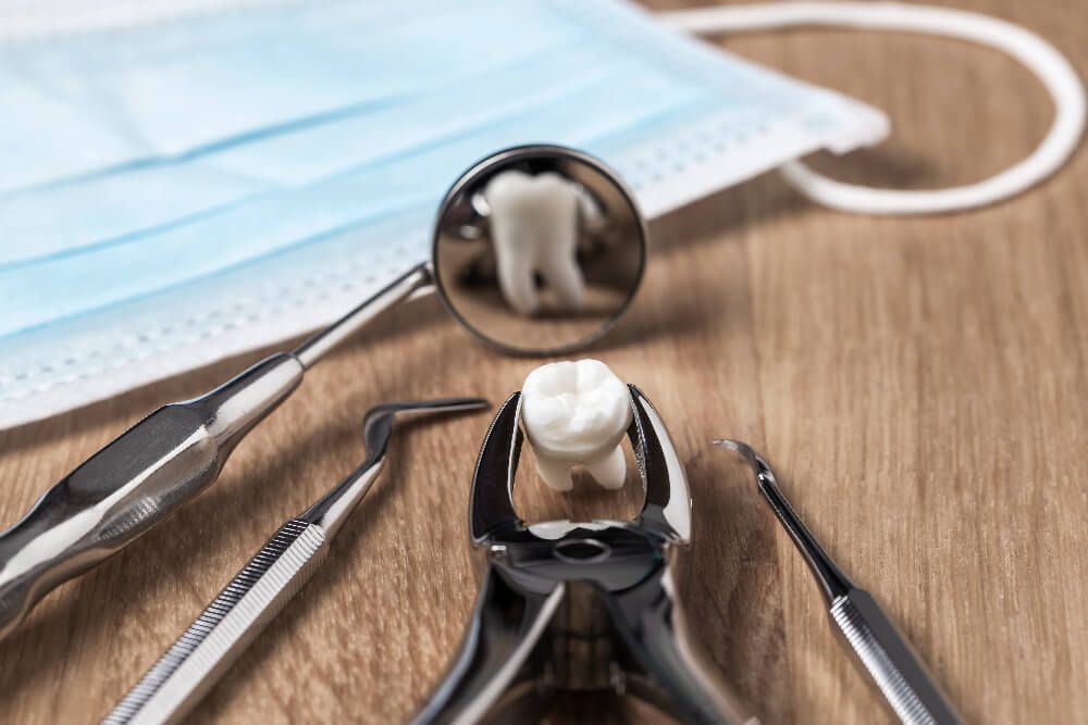 Safe, gentle tooth extraction in Naperville