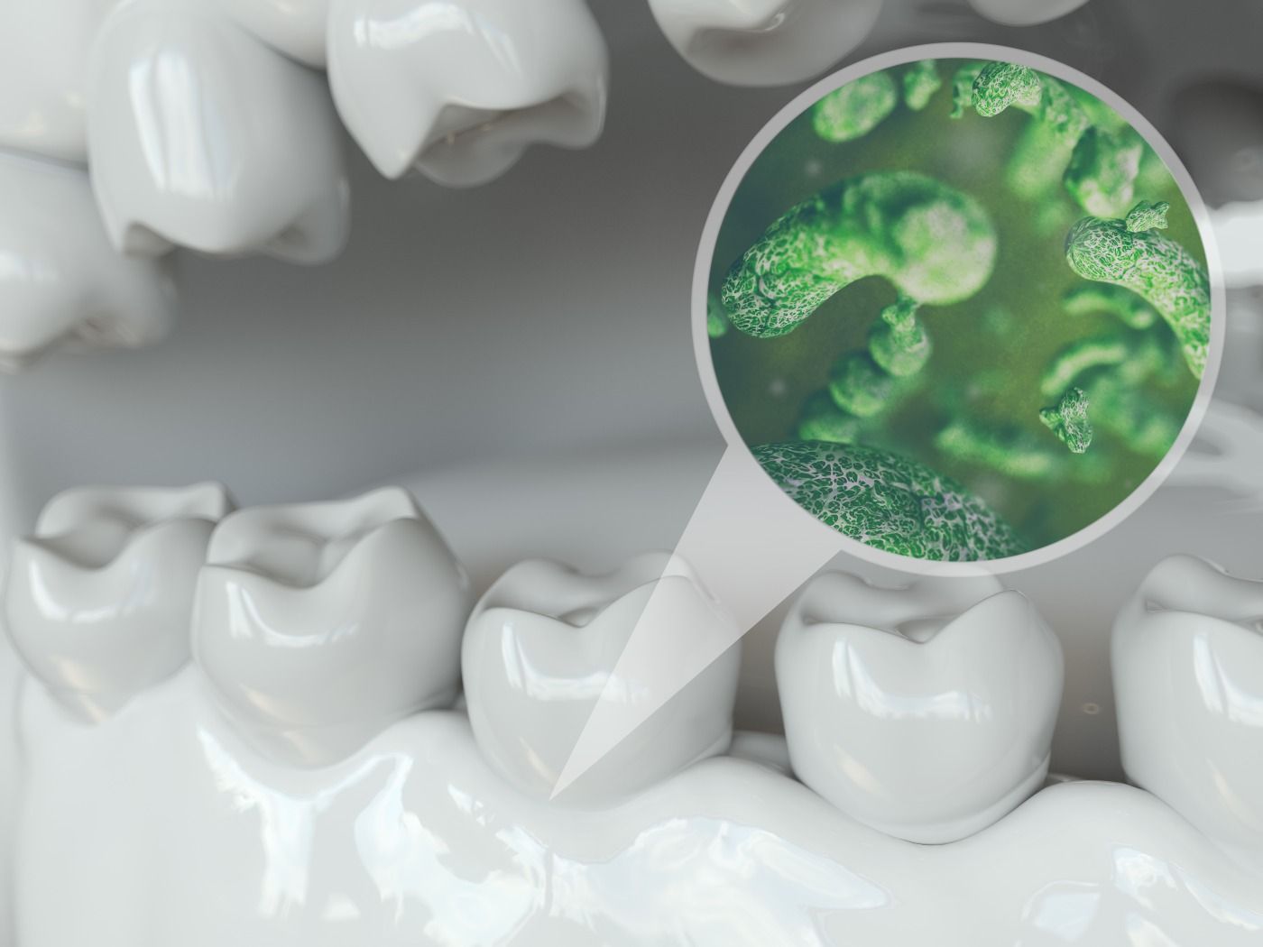 Preventive dental care in Naperville