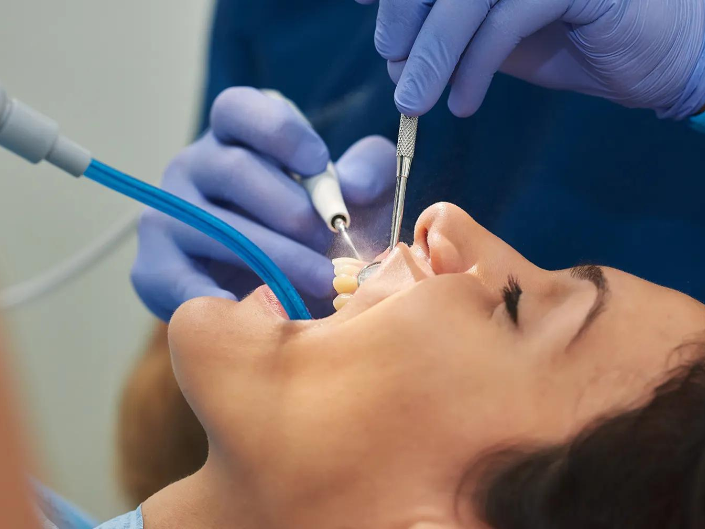 Root canal therapy in Naperville