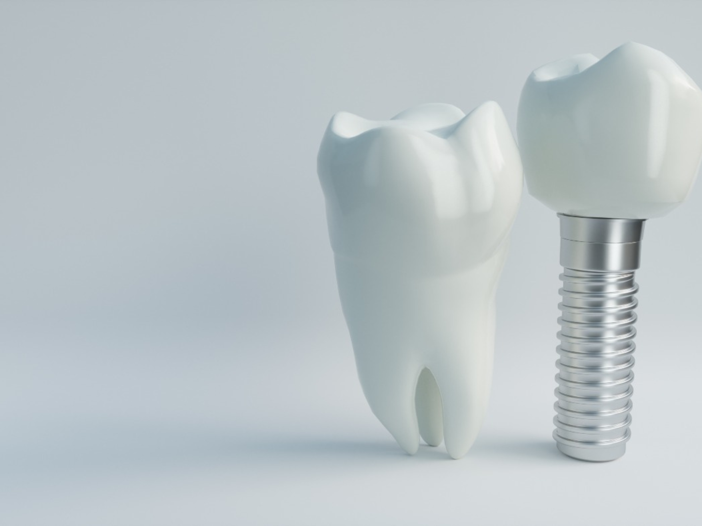 Dental implants in Naperville